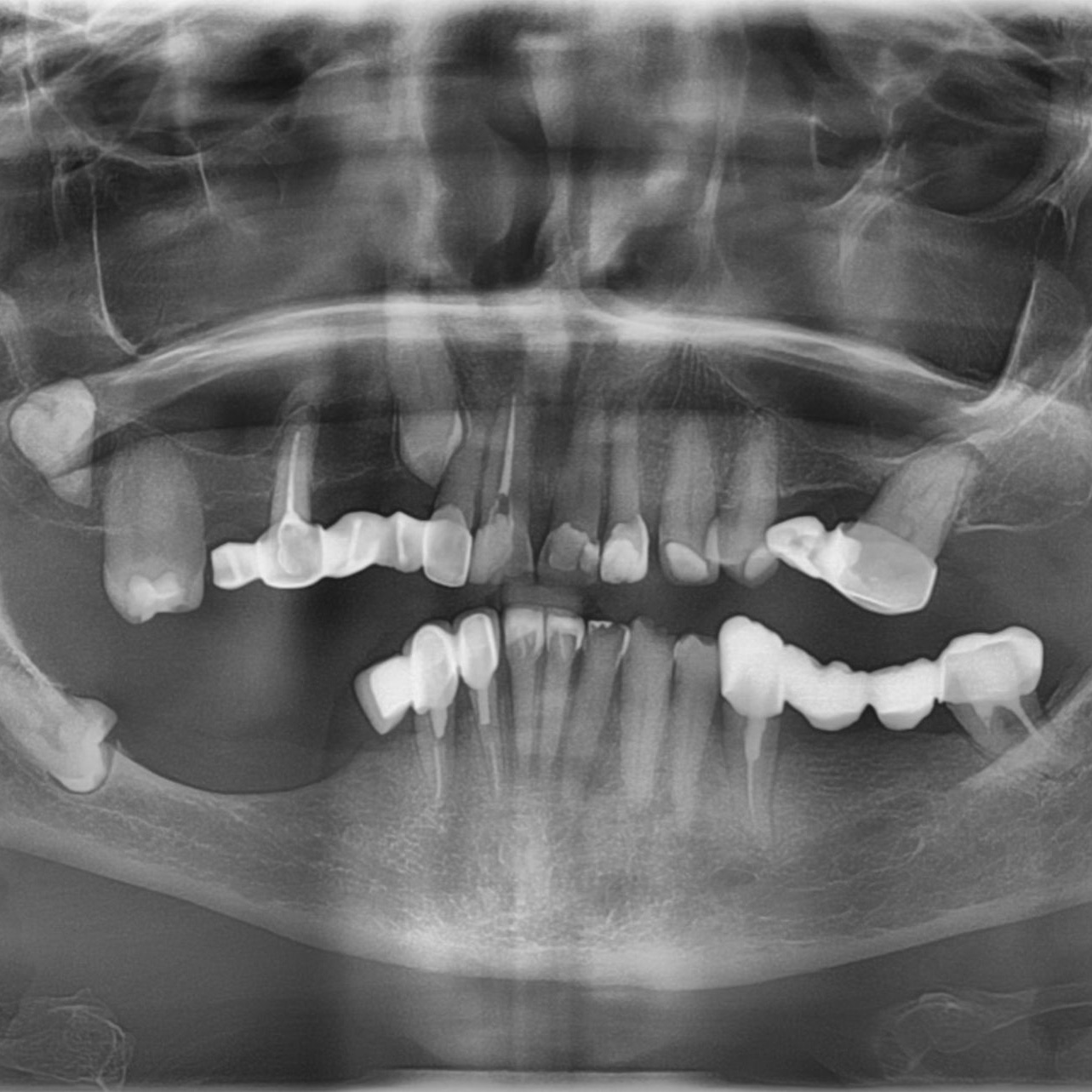 foto Aplikacja mobilna DentX - nowoczesna nauka radiologii stomatologicznej i szczękowo-twarzowej