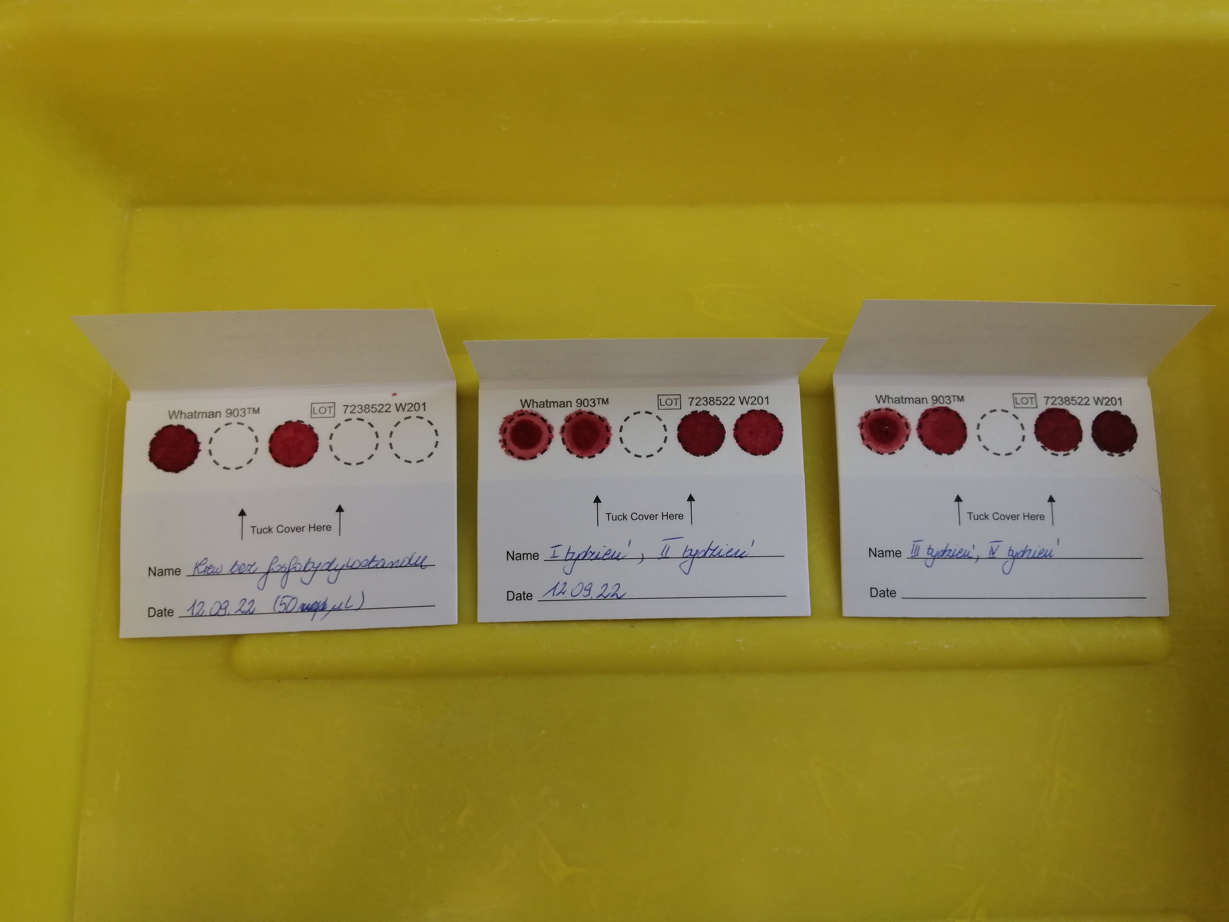 Na zdjęciu trzy karty testowe z próbami krzyżowymi krwi.