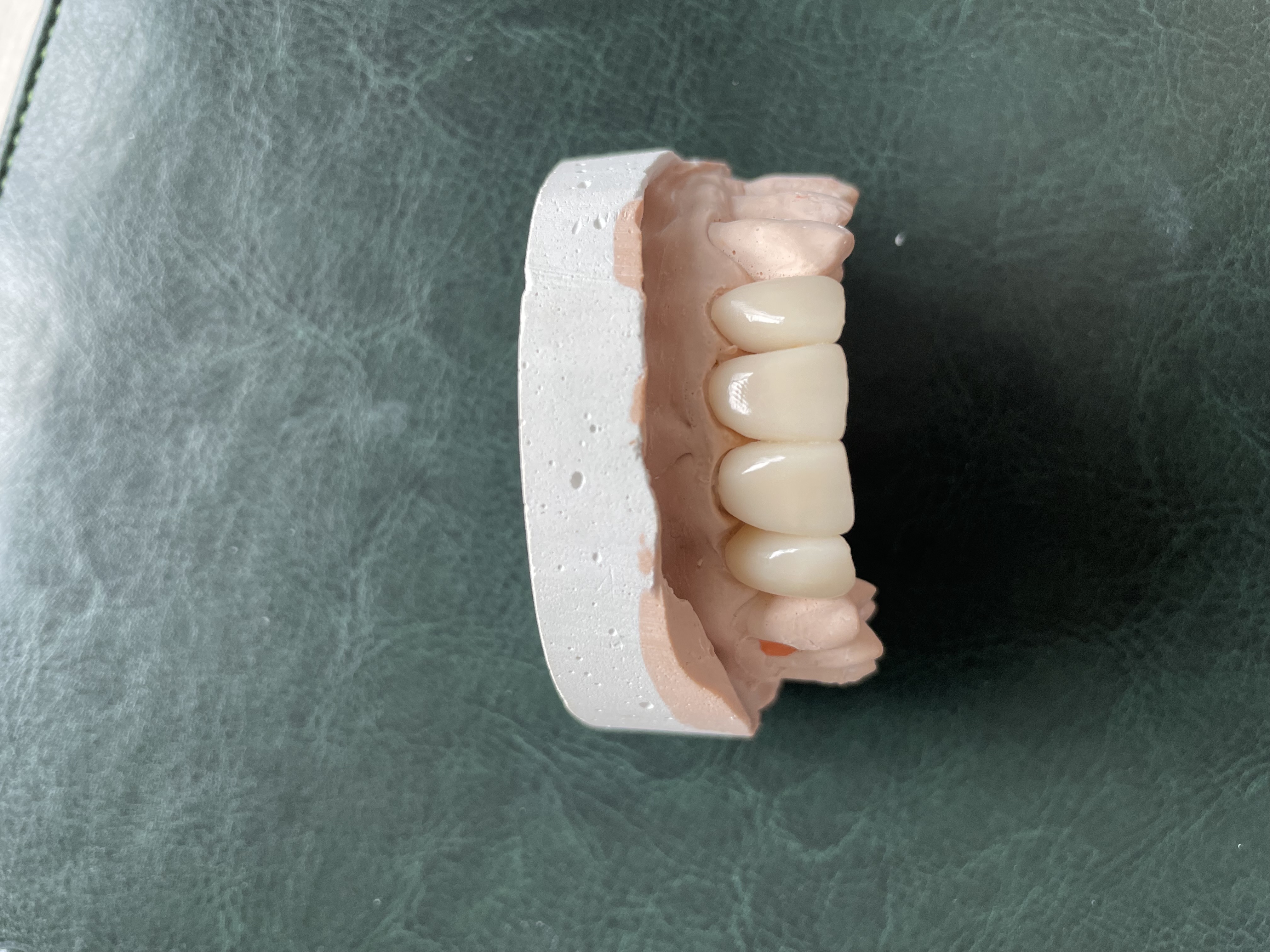 model zębów górnej szczęki wydrukowany a drukarce 3D