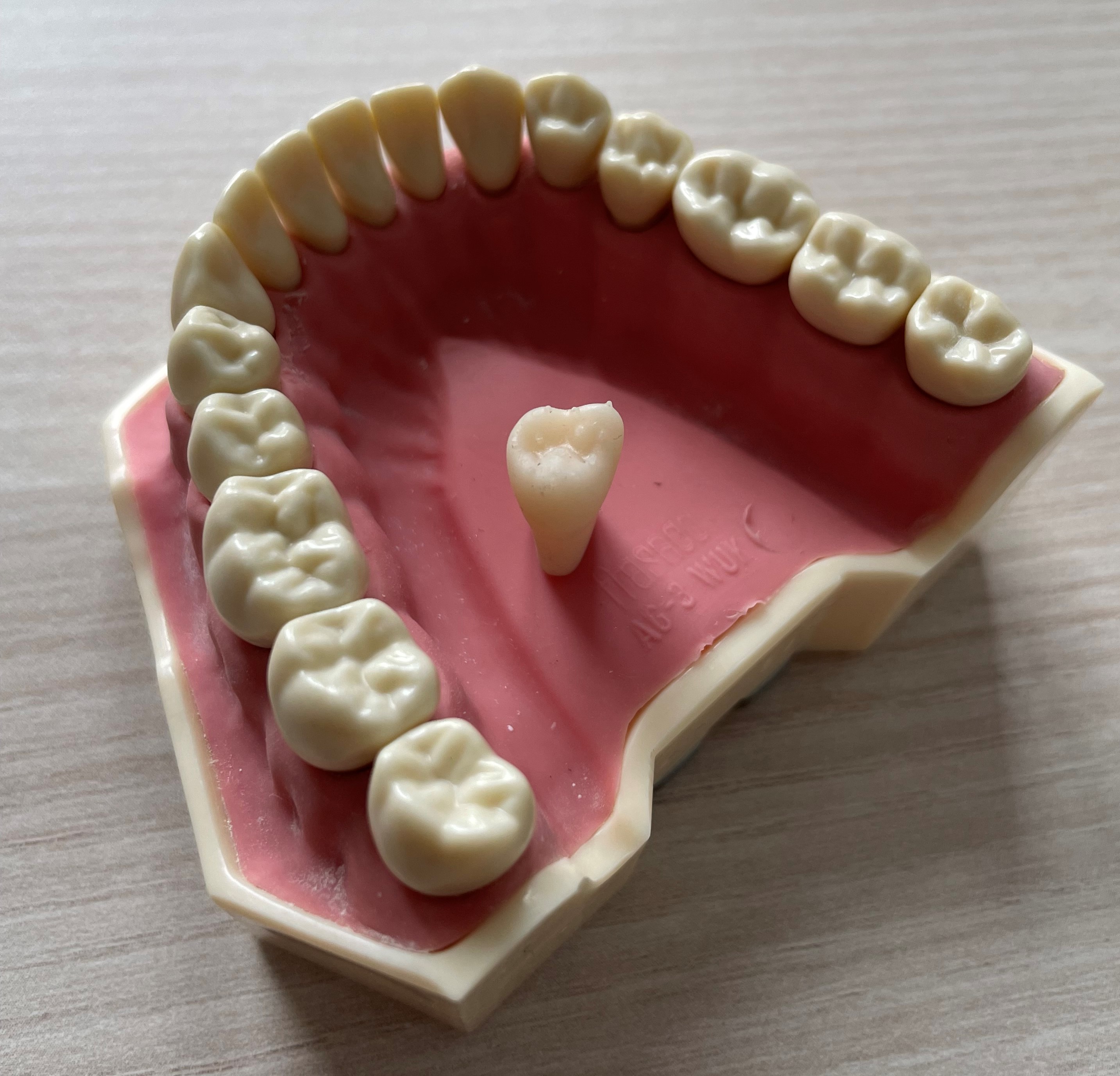 model zębów dolnej szczęki wydrukowany w drukarce 3D