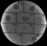 foto Czy bakteriofagi mogą pom&oacute;c w walce przeciwko wzrastającej oporności bakterii na antybiotyki?