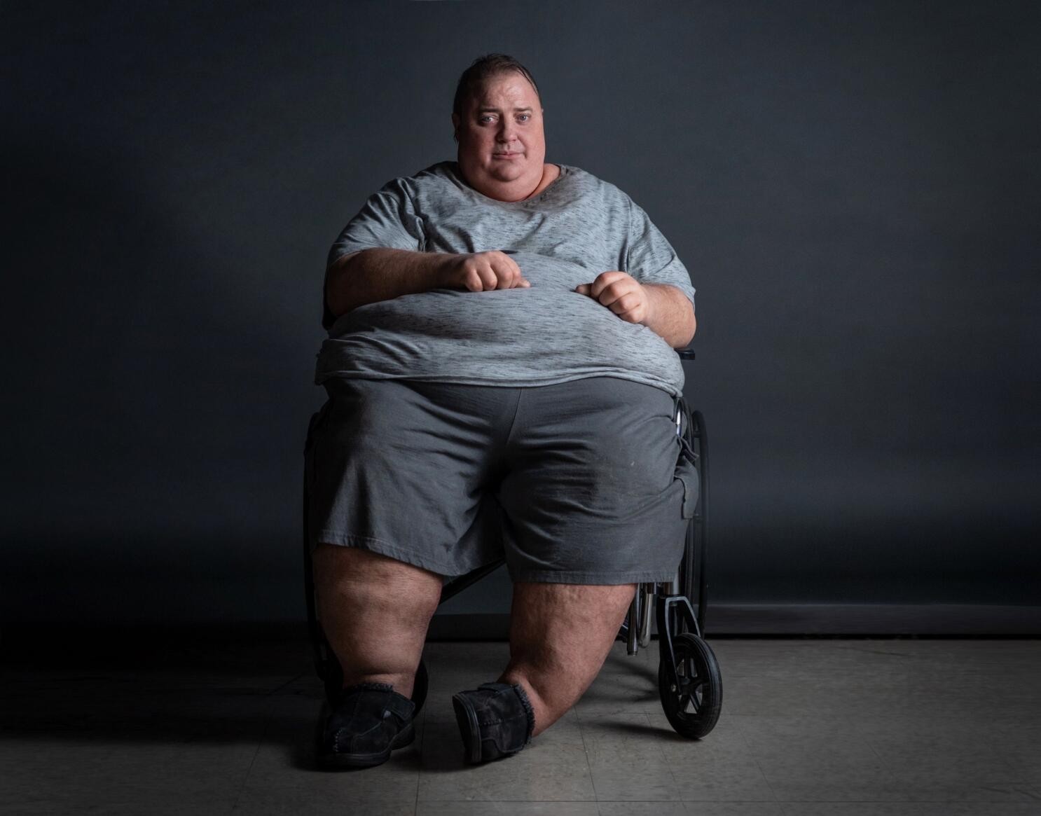 A man with significant overweight